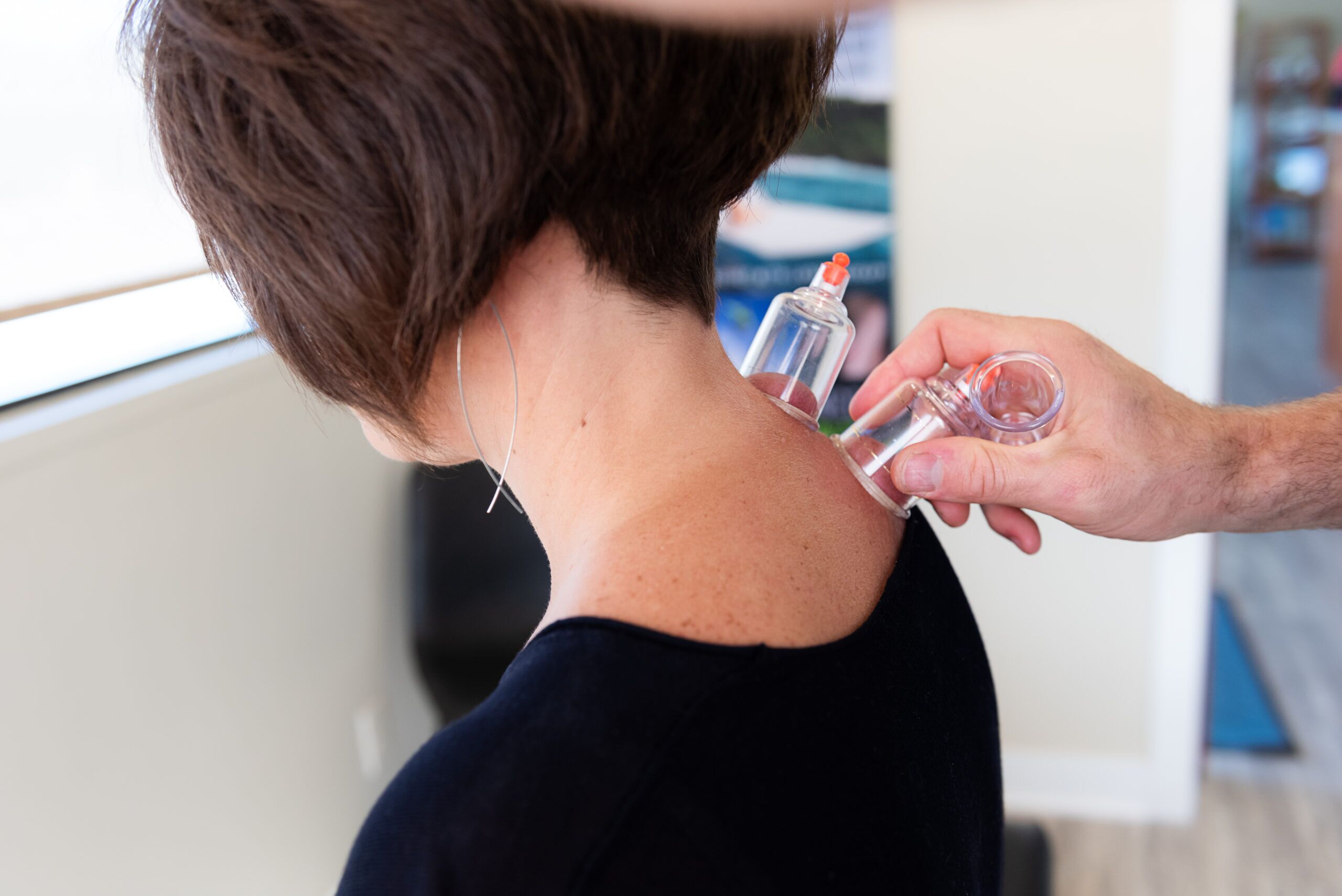 Cupping therapy st peter mn