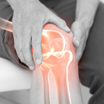 Knee injuries treated by St. Peter Chiropractor.